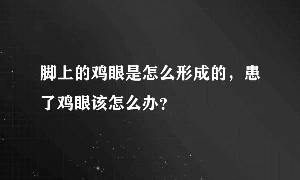 脚上的鸡眼是怎么形成的，患了鸡眼该怎么办？