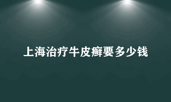 上海治疗牛皮癣要多少钱