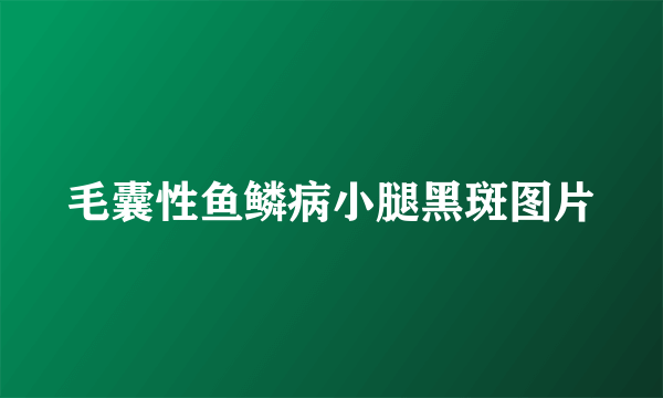 毛囊性鱼鳞病小腿黑斑图片