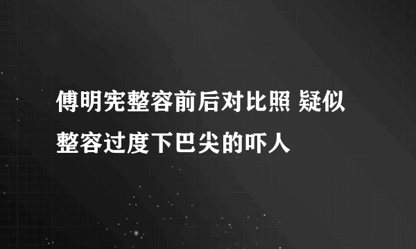 傅明宪整容前后对比照 疑似整容过度下巴尖的吓人