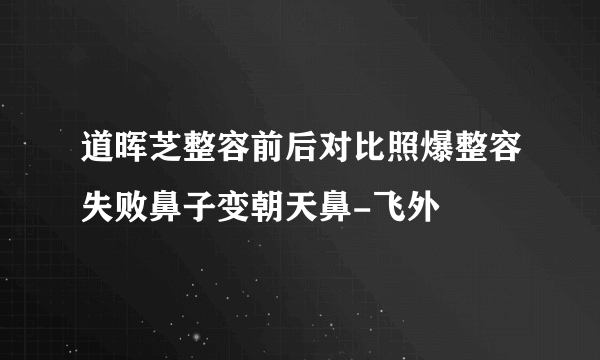 道晖芝整容前后对比照爆整容失败鼻子变朝天鼻-飞外