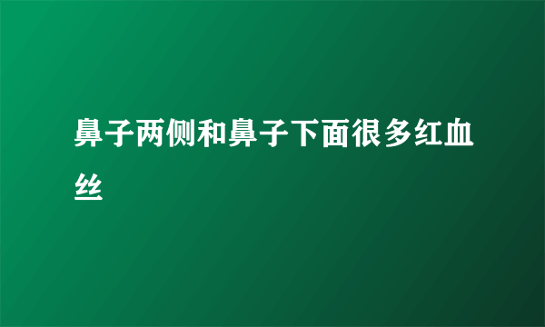 鼻子两侧和鼻子下面很多红血丝