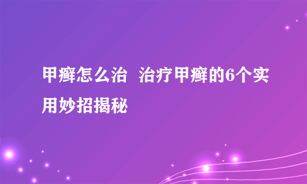 甲癣怎么治  治疗甲癣的6个实用妙招揭秘