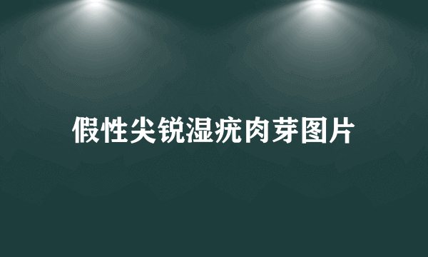 假性尖锐湿疣肉芽图片