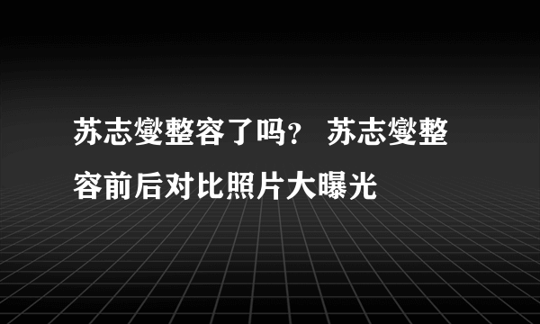 苏志燮整容了吗？ 苏志燮整容前后对比照片大曝光