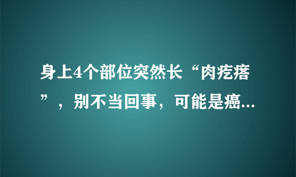 身上4个部位突然长“肉疙瘩”，别不当回事，可能是癌症信号！