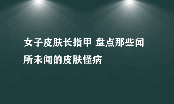 女子皮肤长指甲 盘点那些闻所未闻的皮肤怪病