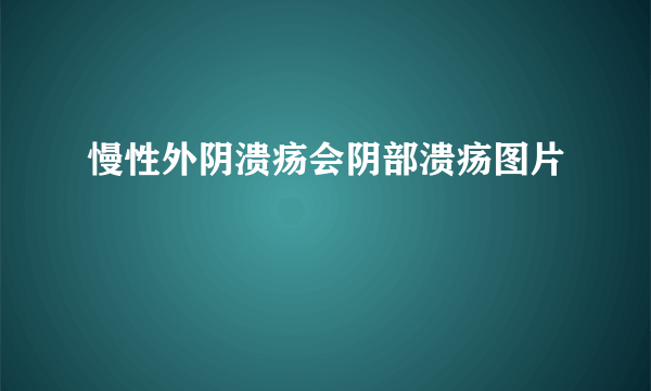 慢性外阴溃疡会阴部溃疡图片