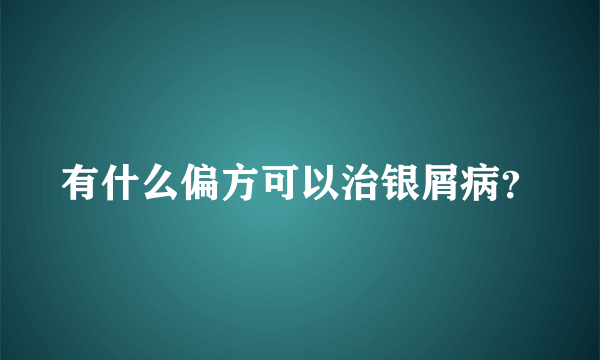 有什么偏方可以治银屑病？