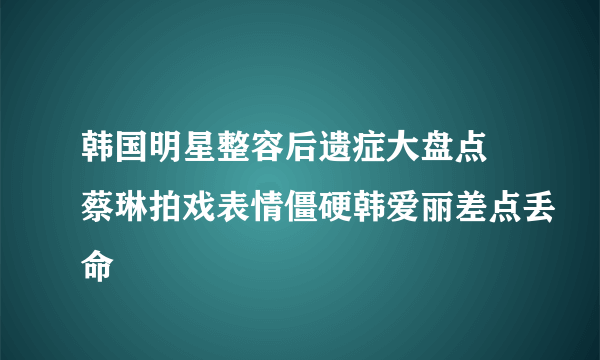 韩国明星整容后遗症大盘点 蔡琳拍戏表情僵硬韩爱丽差点丢命