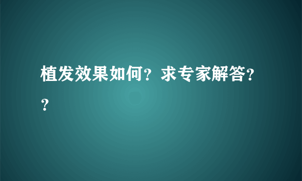 植发效果如何？求专家解答？？