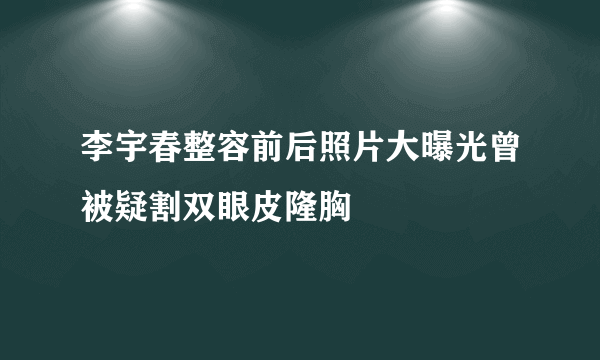 李宇春整容前后照片大曝光曾被疑割双眼皮隆胸