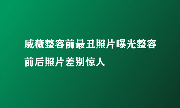 戚薇整容前最丑照片曝光整容前后照片差别惊人